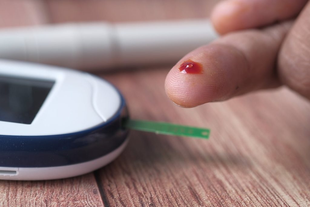 how often should you test blood sugar level
