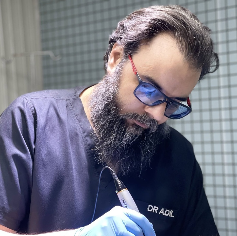 best hair transplant peshawar